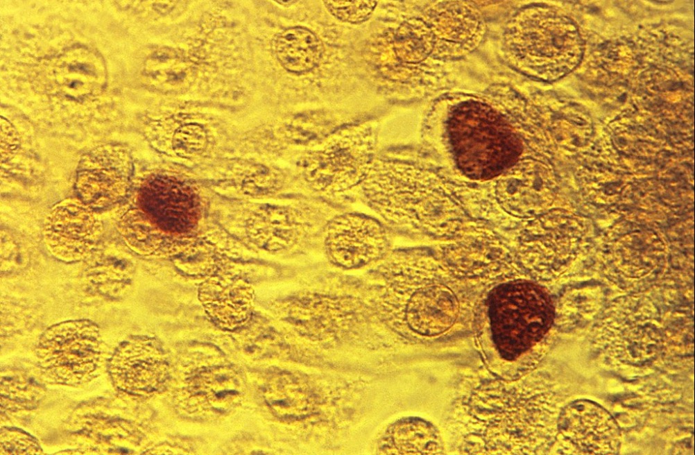 Bactéria Chlamydia trachomatis vista por microscópio eletrônico.